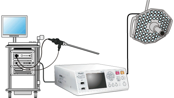 接続設定のいらない映像自動認識