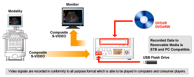 NTSC/PAL Connection